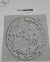 first cycle embryo transfer.jpg
