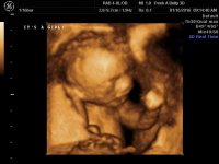 BABY_17.jpg