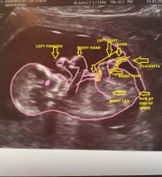 UltrasoundCB.jpg