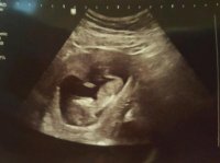 ultrasound 2-3-16.jpg