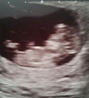 11 week scan.jpg