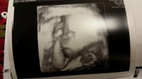 20160209_113055.jpg
