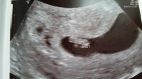 6+6 scan.jpg