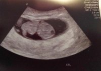 2016-02-17.jpg