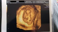 ultrasound01.jpg