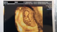 ultrasound02.jpg