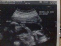 baby - 18w6d.jpg