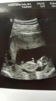 baby11weeks.jpg