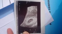 IMG-20160313-WA0003.jpg