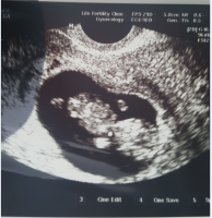 baby.PNG