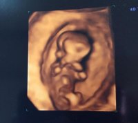baby1.jpg