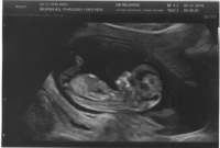 babyultrasound.png