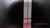 Acumed PT 5.11.16 011 Upload1.jpg