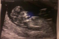 new baby 11 week ultrasound 2 edit for web.jpg