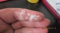 POSSIBLE REXALL PROGRESSION AND NEW CM 3 DAYS LATE 045 (640x360).jpg