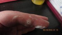 POSSIBLE REXALL PROGRESSION AND NEW CM 3 DAYS LATE 046 (640x360).jpg