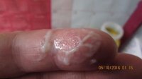 POSSIBLE REXALL PROGRESSION AND NEW CM 3 DAYS LATE 055 (640x360).jpg