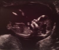 Sonogram 5.20.16.jpg