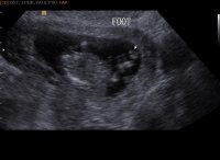 BABY DUNKLIN_0006.jpg