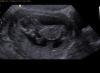 BABY DUNKLIN_0015.jpg