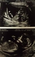12w4d.jpg