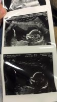 baby2.jpg