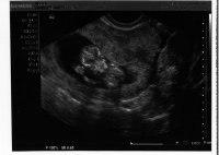 baby 12 week #2.jpg