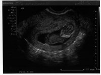 Baby 12 week #3.jpg