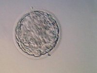 embryo 08-05-2016.jpg