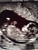 baby scan number 3.jpg