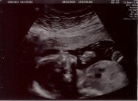Baby Ellie Side.jpg