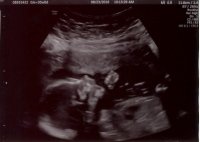 Baby Ellie Side 2.jpg