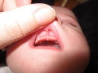 tonguetiedtop.jpg