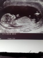 12week scan.jpg