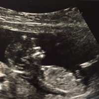 Baby Coutu 1.jpg Baby Coutu 1.jpg