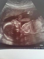 21wks3.jpg