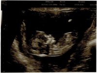 12w5d-name-removed.jpg