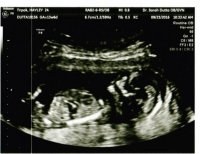 baby#3.jpg