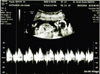 baby#3heartbeat.png