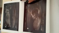 20161004_100716.jpg