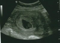 7 wks 6 day ultrasound - Copy.jpg