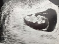 Baby#3at7weeks.jpg