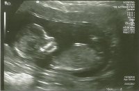 12wk Scan 03.jpg