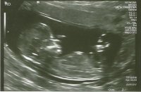 12wk Scan 01.jpg