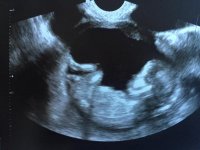 ultrasound13.5.jpg