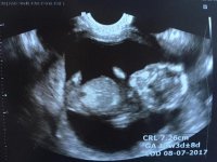 ultrasound13.5 3.jpg