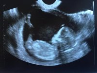 ultrasound13.5.jpg