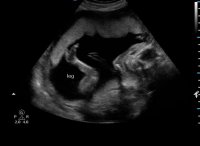 babystretching_jpg.jpg