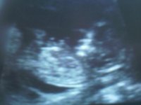 Baby Mammoth at 12+5.jpg