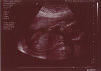 Baby 20+3.JPG